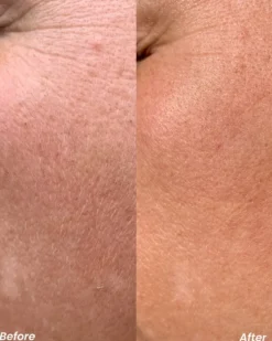 clay and glow retinol nacht serum Anti-aging Serum