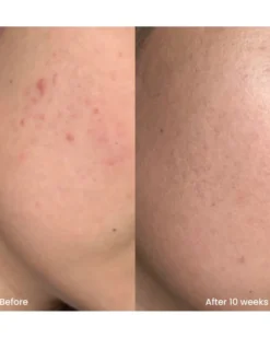 clay and glow triple aha face gel cleanser VERZACHTENDE REINIGINGSGEL
