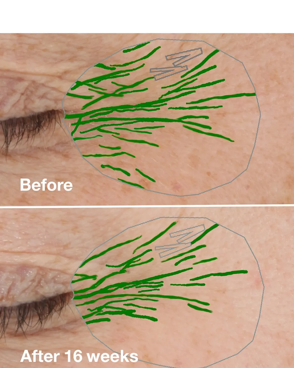 clinique clinique smart clinical repair™ wrinkle correcting cream ANTI-AGING HYDRATERENDE CRÈME - ALLE HUIDTYPES