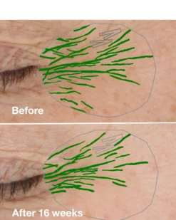 clinique clinique smart clinical repair™ wrinkle correcting rich cream ANTI-AGING HYDRATERENDE CRÈME - DROGE HUID