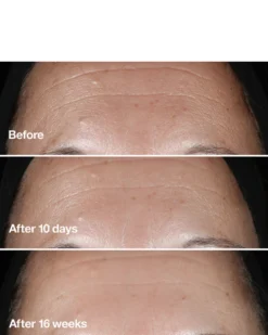 clinique clinique smart clinical repair™ wrinkle correcting serum ANTI-AGING SERUM