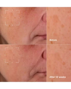 clinique even better clinical™ dark spot clearing serum Serum