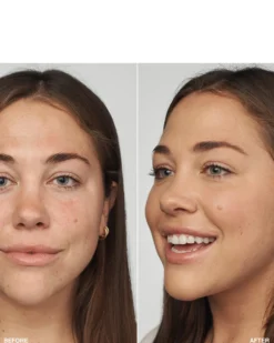 clinique even better™ clinical serum foundation HYDRATERENDE & EGALISERENDE FOUNDATION SPF 20 - 24U LANGHOUDEND & WATERPROOF