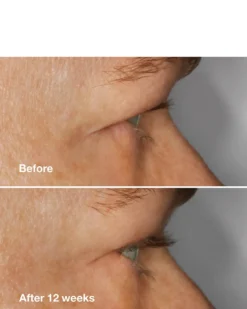 clinique high impact™ lash amplifying serum WIMPERSERUM - VOOR LANGERE & VOLLERE WIMPERS