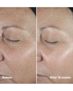 clinique smart clinical Anti-Wrinkle Correcting Serum