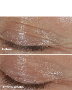 clinique smart clinical repair™ wrinkle correcting eye cream OOGCRÈME - ANTI-AGING & HYDRATEREND - VERMINDERT RIMPELS