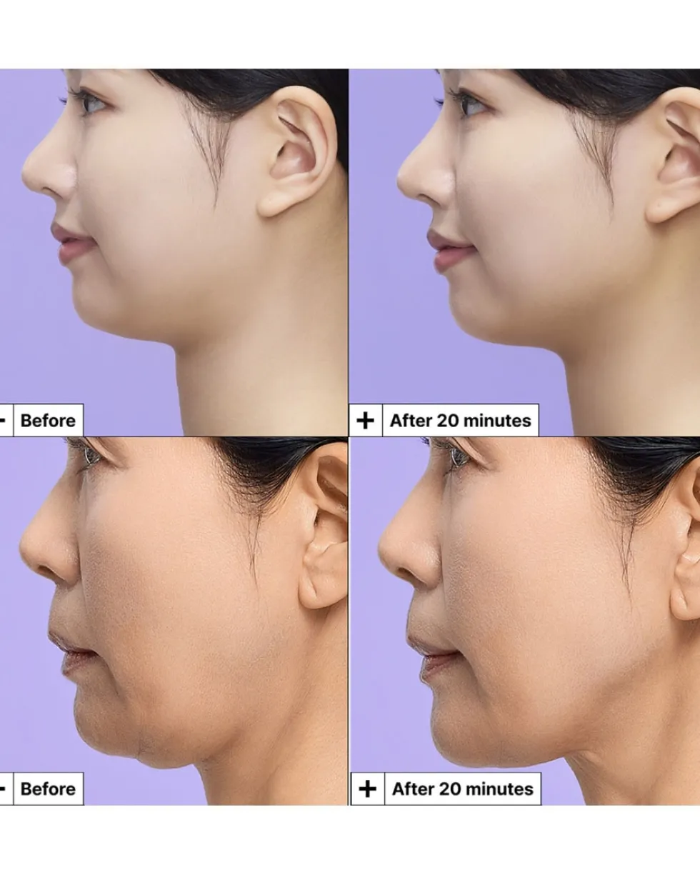 dr jart+ cryo rubber V-Sculpt Jawline Lifting Masker
