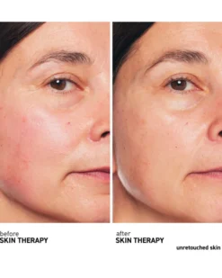 erborian skin therapy Multi-perfecterende nachtolie-serum