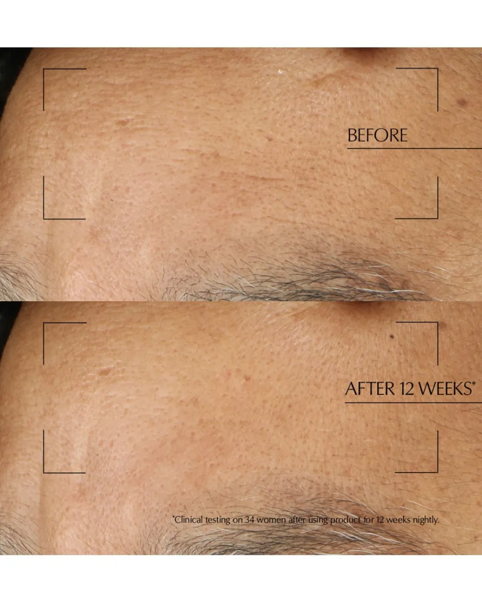 estée lauder advanced night repair overnight treatment Intensieve nachtverzorging met Hyaluronzuur