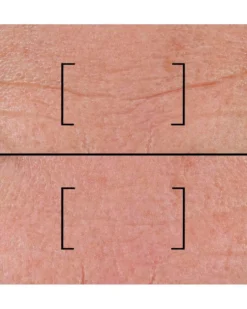 filorga time-filler Serum