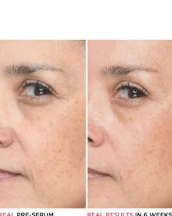 it cosmetics bye bye serum IT BYE BYE LINES HYALURONIC ACID SERUM