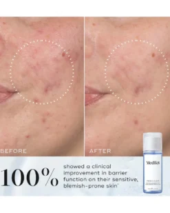 medik8 press and clear refill Exfoliating 2% BHA Tonic Gentle-Release Salicylic Acid