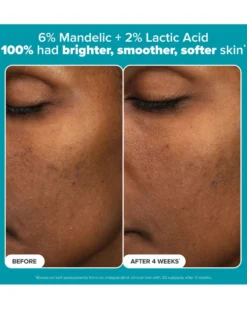 paula's choice mini-kit Multi-Level Exfoliatie