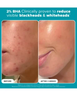 paula's choice skin perfecting SKIN PERFECTING 2% BHA Liquid Exfoliant