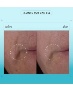 philosophy dose of wisdom bouncy skin reactivating serum