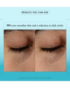 philosophy dose of wisdom dark circle brightening oogcrème