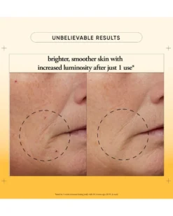 philosophy the microdelivery Vitamin c resurfacing peel kit