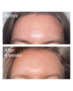 the inkey list advanced retinal serum Geavanceerd Retinal Serum