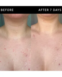 the inkey list body care Exfoliërende bodystick met glycolzuur