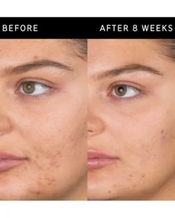 the inkey list salicylic acid cleanser SALICYLZUUR REINIGER