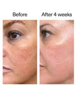 the inkey list starter retinol serum Retinol Serum voor Beginners