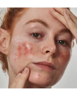 the inkey list supersolutions SUPERSOLUTIONS 10% AZELAIC ACID SERUM
