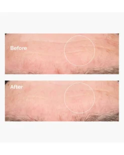the ordinary dryness & dehydratation Hyaluronic Acid 2% + B5