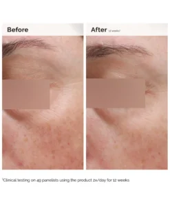 the ordinary uneven skin tone/brightner NIACINAMIDE 5% FACE & BODY EMULSION